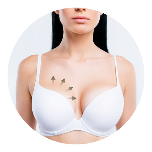 Mentor® 曼陀女王波隆乳手術 Mentor® 曼陀女王波隆乳手術