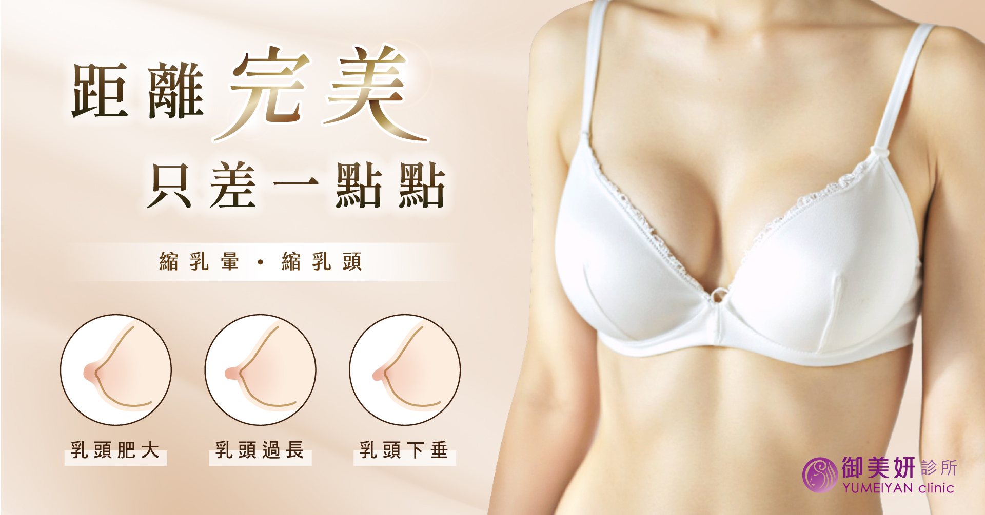 提乳手術 提乳手術