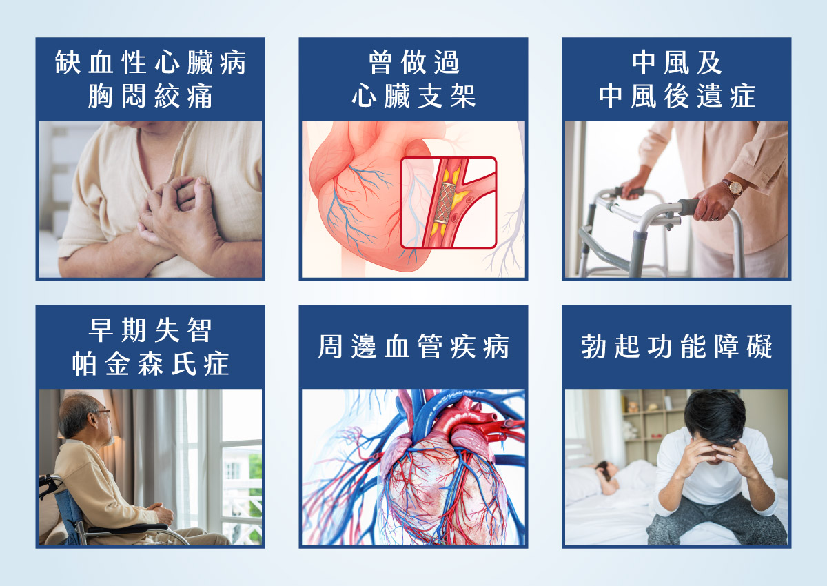 EECP 體外反搏