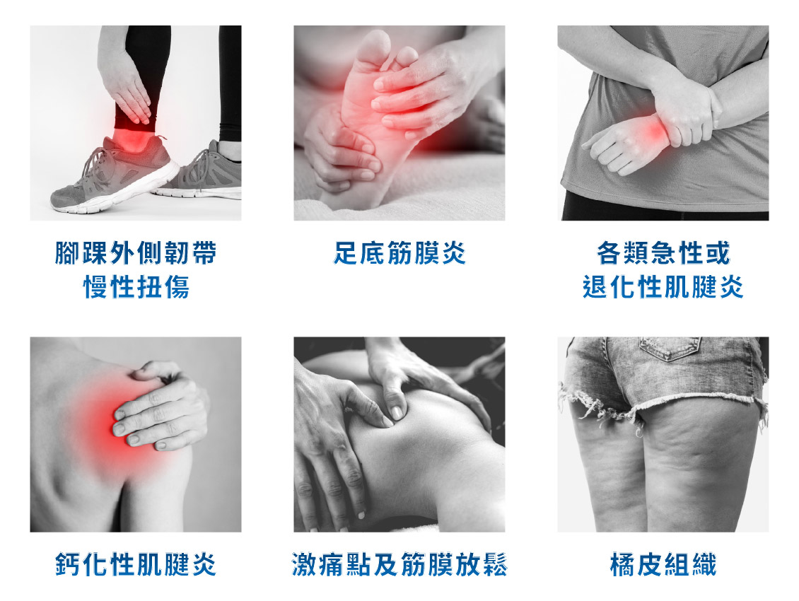 EMS 震波治療適用疾病示意