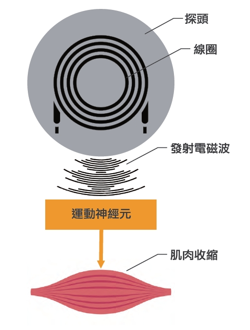 星肌動減脂(星肌動椅) 星肌動減脂(星肌動椅)