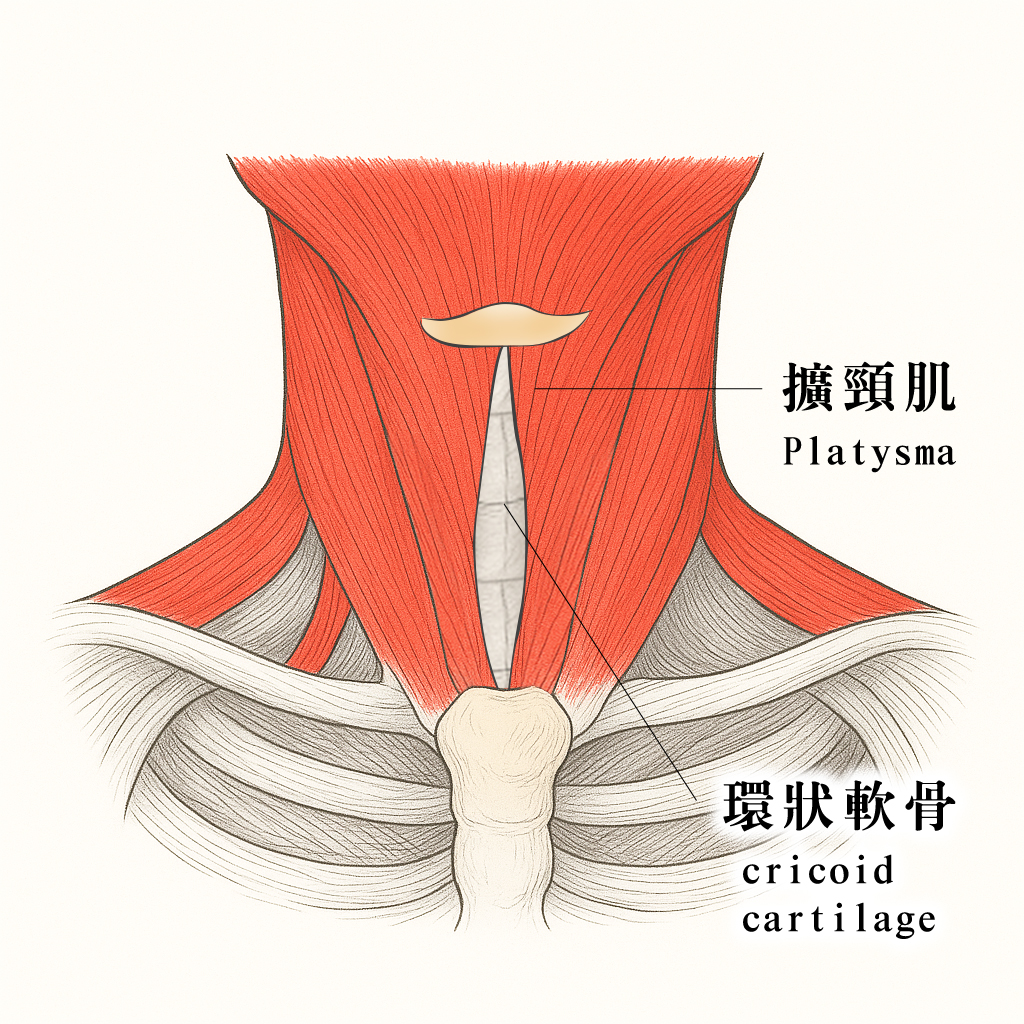 天鵝頸手術 擴頸肌手術示意圖