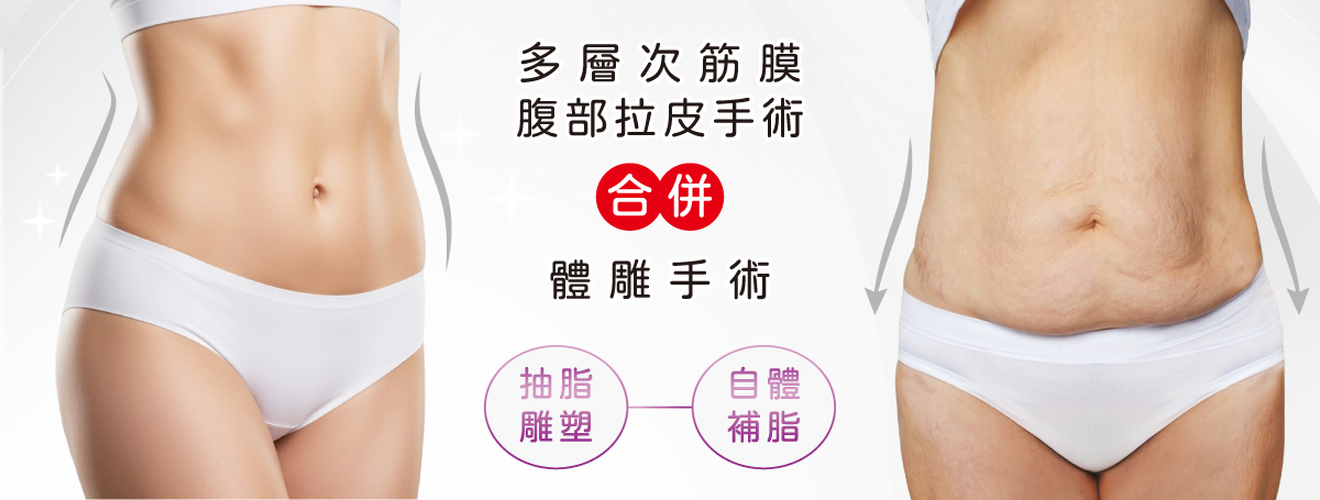 腹部拉皮 腹部拉皮