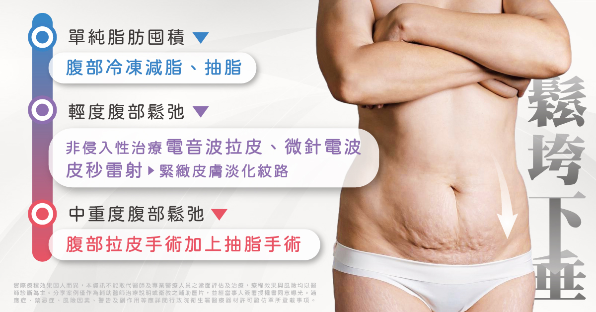 腹部拉皮 腹部拉皮