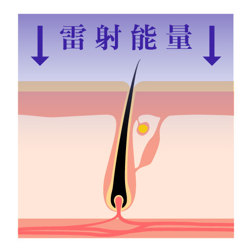 1. 治療