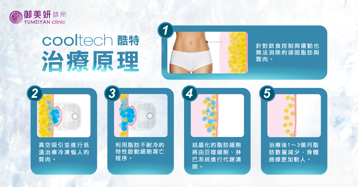 酷特冷凍減脂 Cooltech
