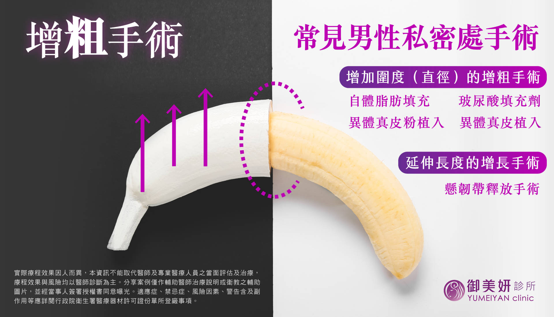 男性私密處手術 男性私密處手術