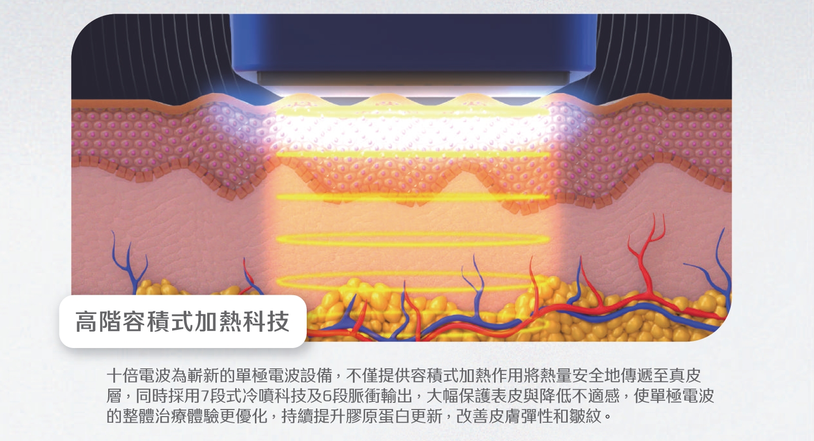 十倍電波作用原理 十倍電波作用原理