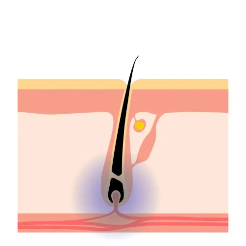 2. 破壞